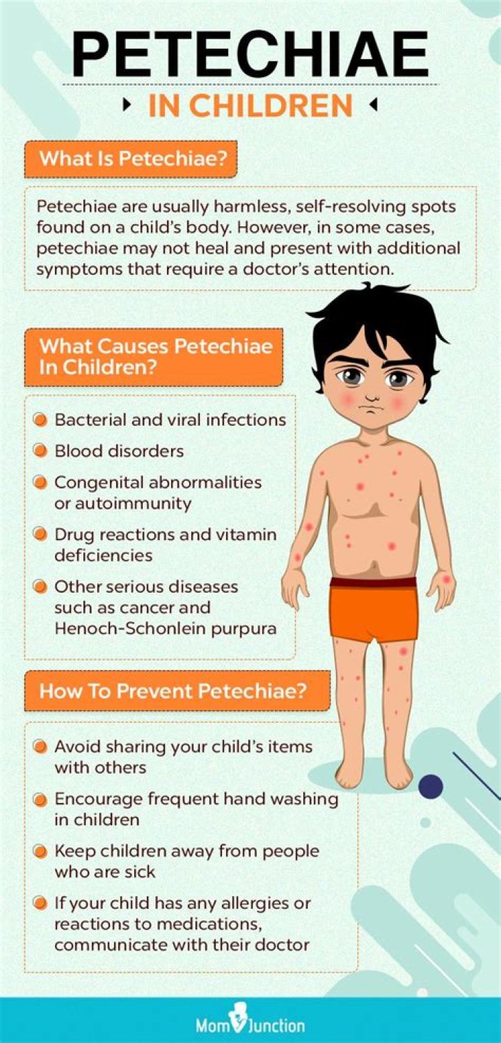 Can petechiae be harmless?
