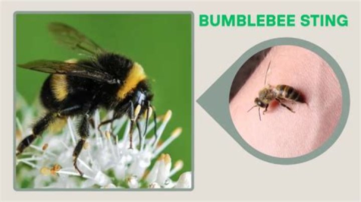 Does a bumblebee sting hurt?