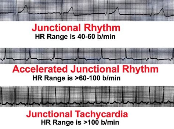 Does atropine work on junctional rhythms?