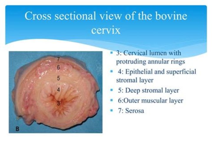 Does cervical ripening hurt?