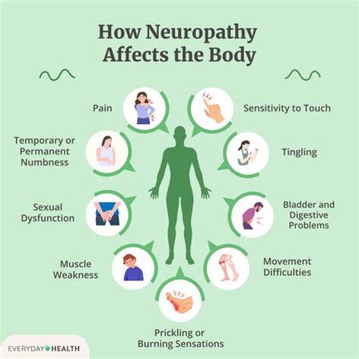 Does neuritis go away?