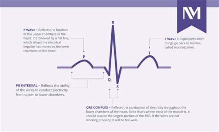 How to explain thready pulse?