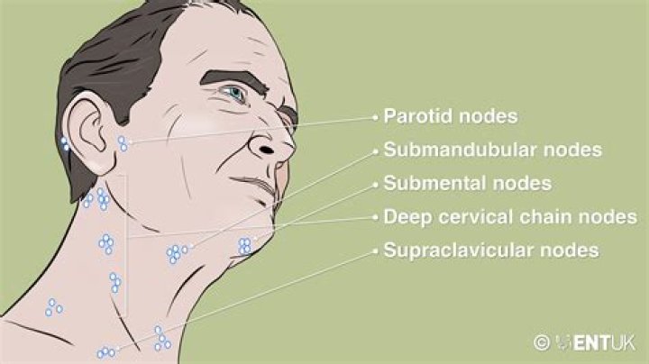 Should lymph nodes be movable?