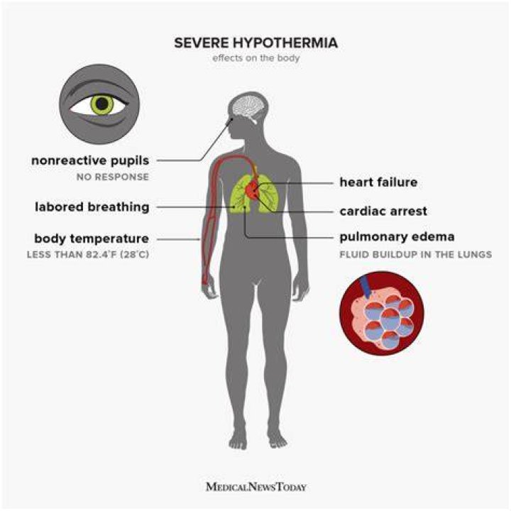 What does hypothermia indicate?