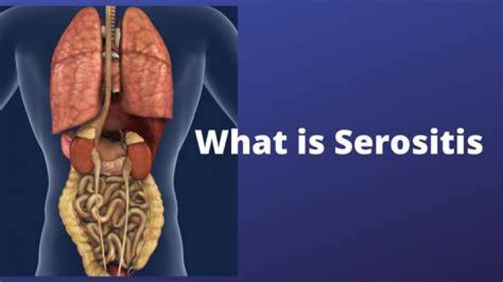 What is multiple serositis?