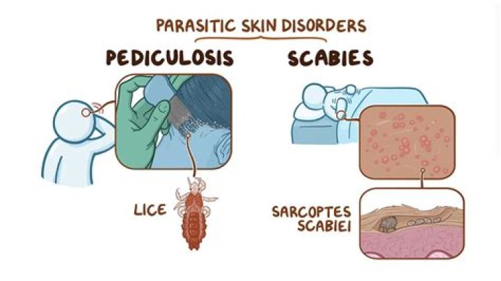 When does pediculosis start?